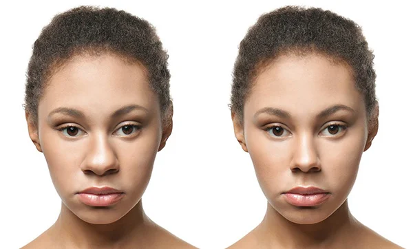 افضل دكتور تجميل انف في مصر 