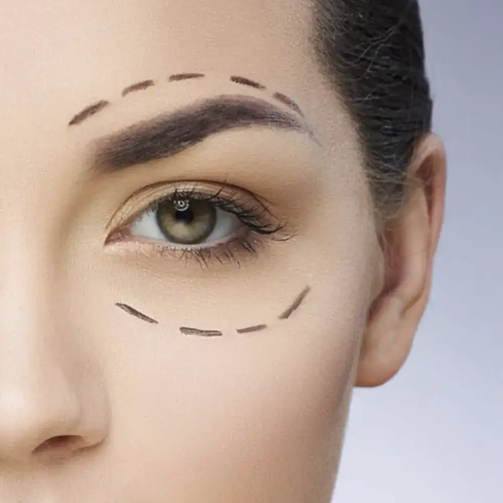 أفضل دكتور تجميل جفون