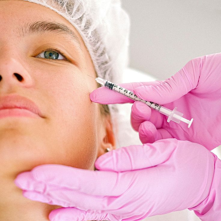 حقن الفيلر تحت العين