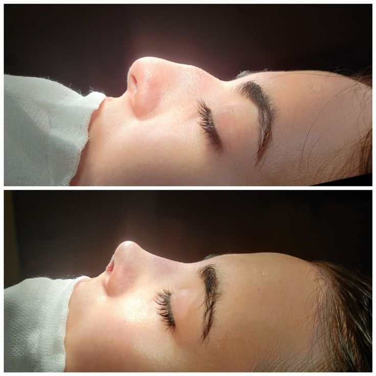 افضل دكتور تجميل انف في مصر