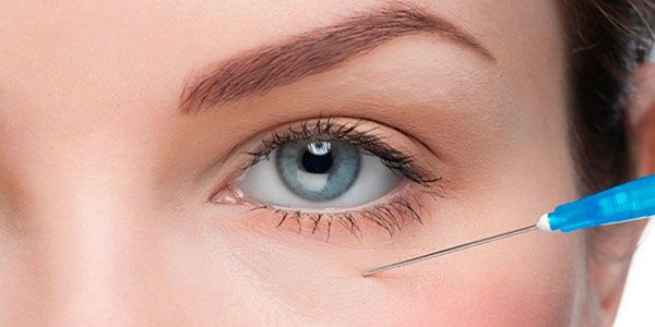 حقن الفيلر تحت العين للهالات السوداء