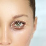 حقن الفيلر تحت العين للهالات السوداء