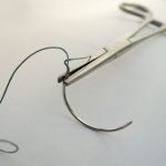 أنواع خيوط الجراحة