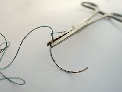 أنواع خيوط الجراحة