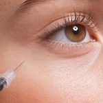 تجربتي مع حقن الفيلر تحت العين