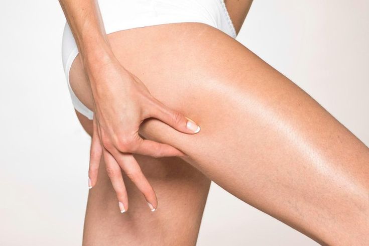  التخلص من ترهلات الفخذين 