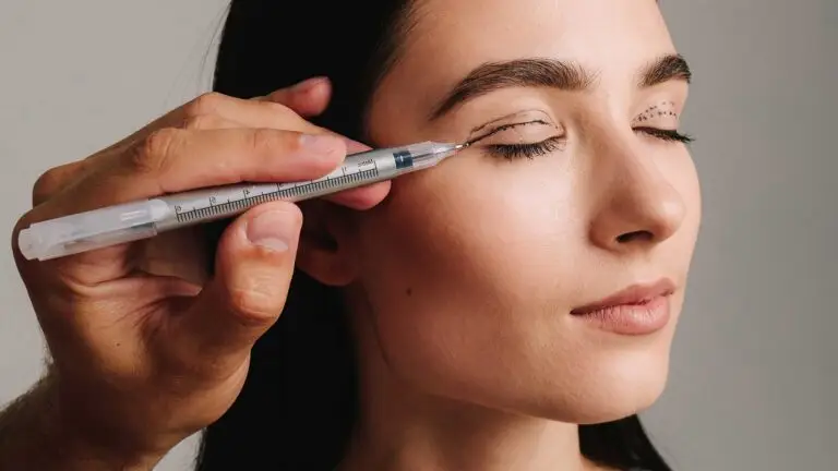 عملية شد الجفون العلوية