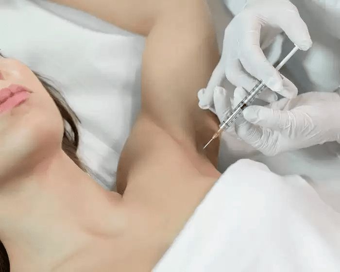 حقن البوتكس للتعرق