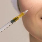 الفرق بين البوتكس والفيلر