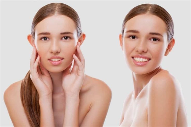 عملية تجميل الأذن بالليزر