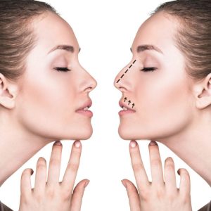 أفضل دكتور تجميل أنف في مصر – د. علي الشافعي