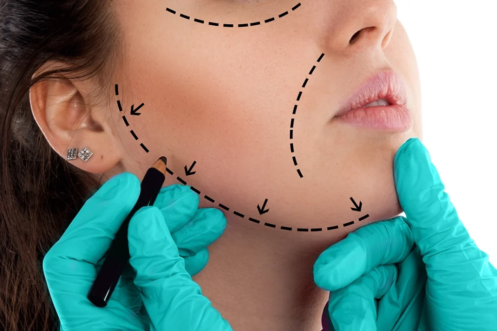 انواع عمليات التجميل للوجه