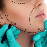 وداعًا للخفسات الغائرة: كيف تحوّل دهون جسمك إلى سلاح سري لجمال وجهك؟