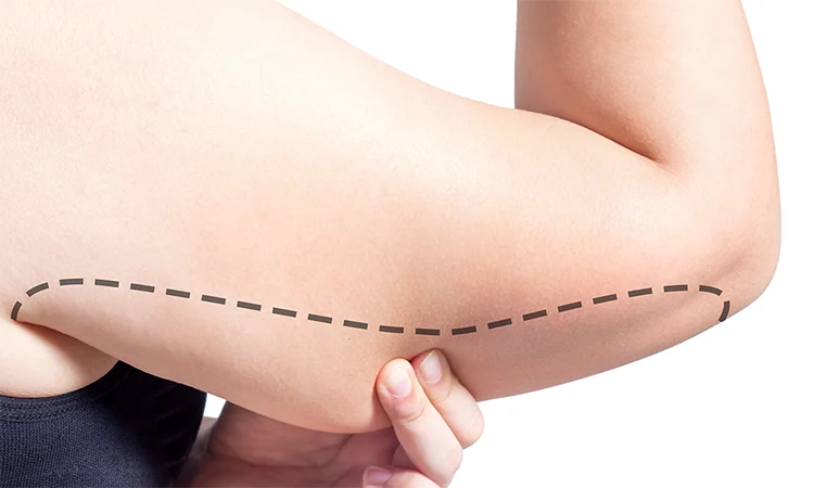 شد الذراعين بالخيوط