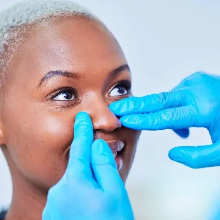 تجميل الأنف ذو الجلد السميك