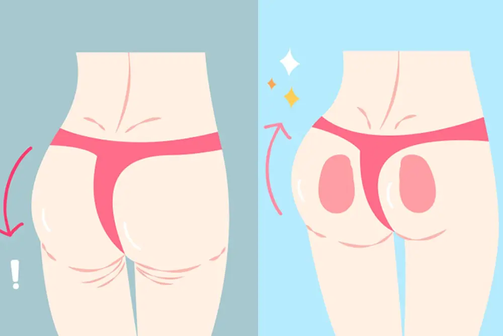 نحت الخصر وتكبير الأرداف