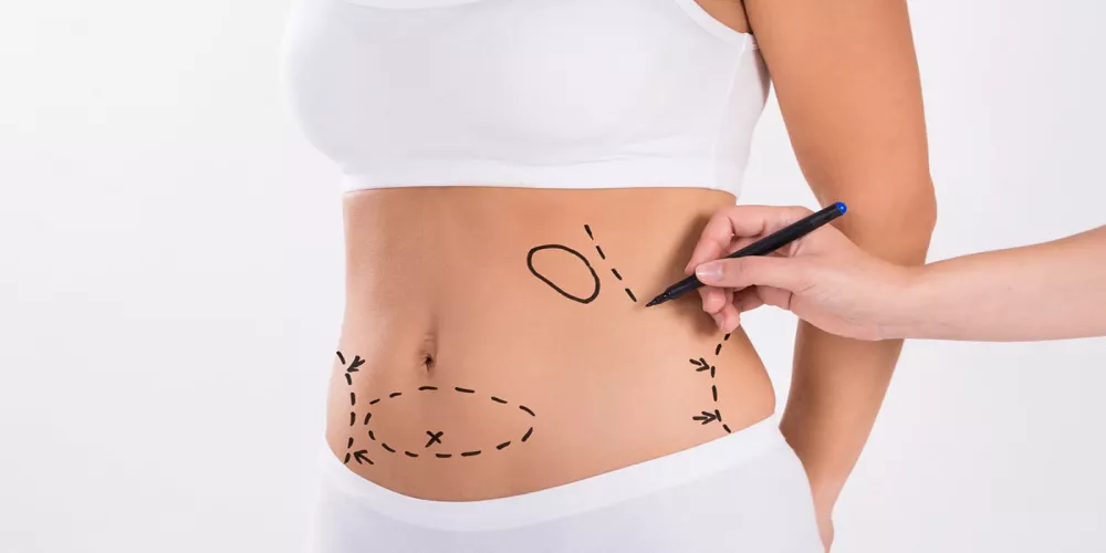 نحت القوام بالجى بلازما