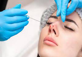 هل عملية تجميل الأنف مؤلمة ؟ كل ما يجب معرفته قبل خضوعك للجراحة