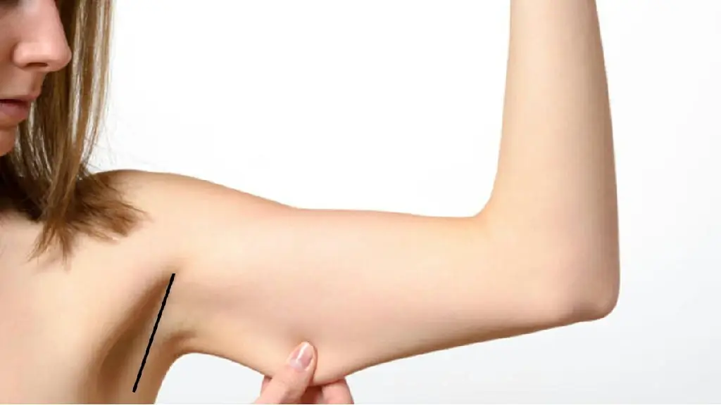 شد الذراعين بالخيوط