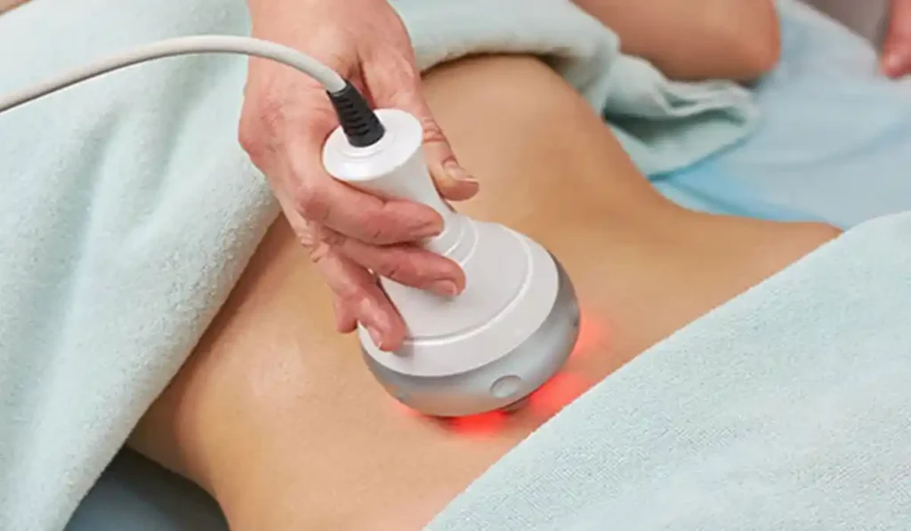 تكلفة نحت الجسم بالليزر