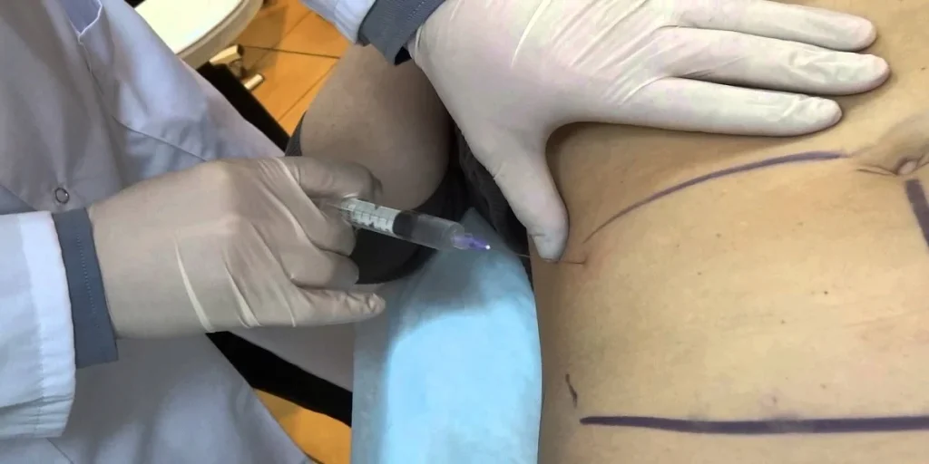 ابر اذابة الدهون