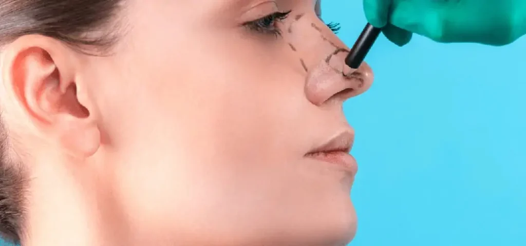 أفضل دكتور تجميل أنف في مصر